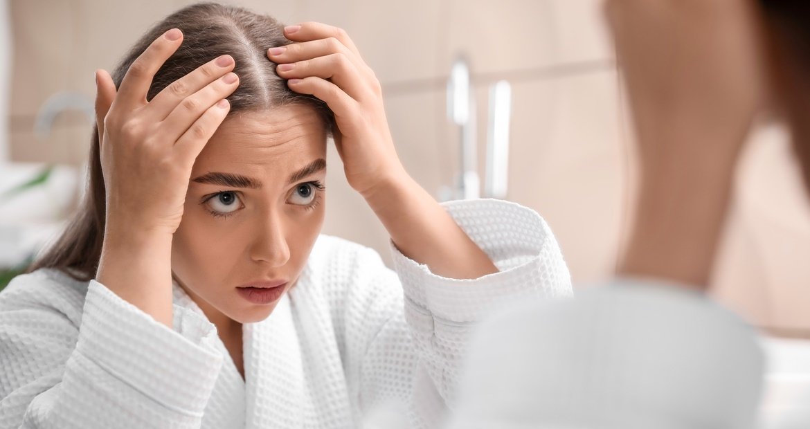 Mulher identifica sintomas da queda de cabelo ou calvície feminina